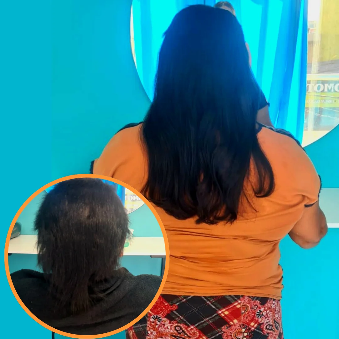 Antes e depois megahair
