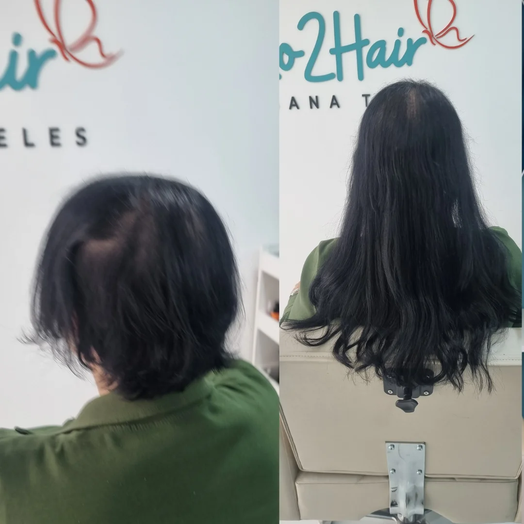 Antes e depois megahair